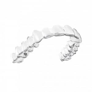 インビザライン_invisalign