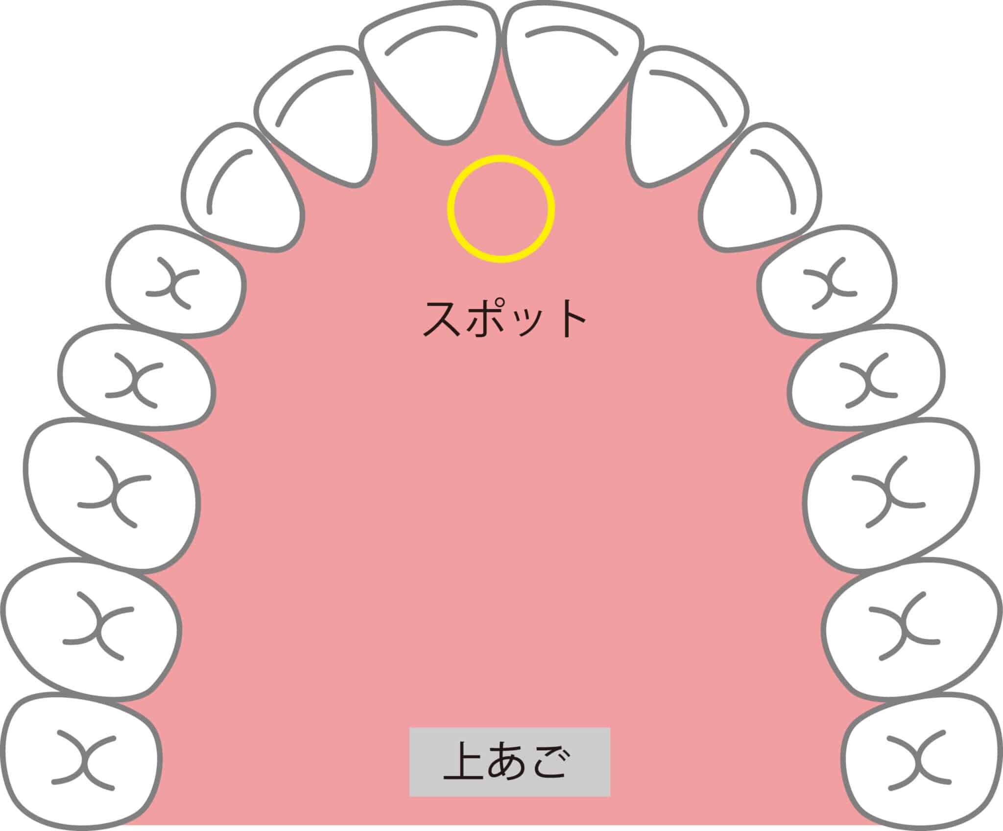 上顎_舌スポット_m7gNIQpLyxPj