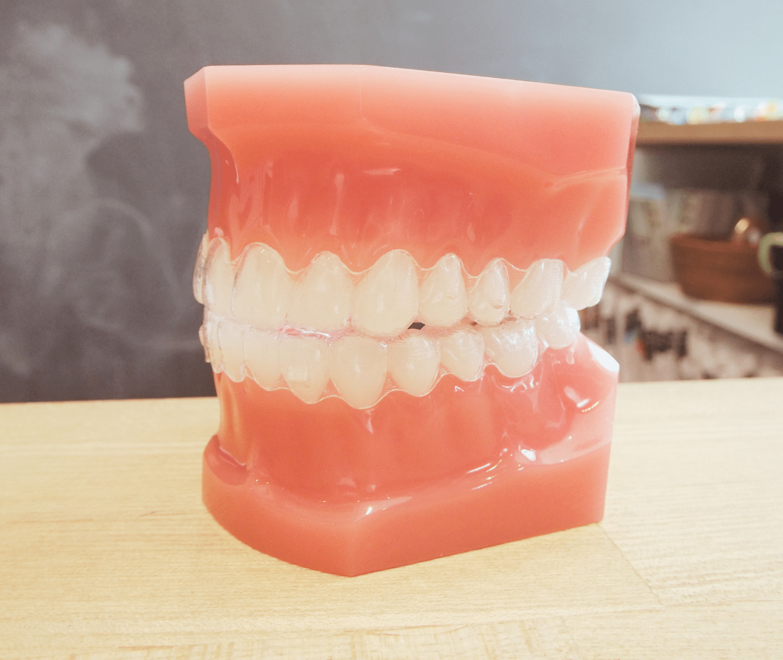 お子さまの歯並び・かみ合わせで気になる症状について、「受け口」「出っ歯」「前歯が咬み合わない」「歯がガタガタ」「すきっ歯」「噛み合わせが深い」など、タイプに分けて解説。