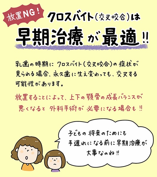 子どもが交叉咬合_4_子供の交叉咬合（クロスバイト）の原因と治療法を解説するイラスト