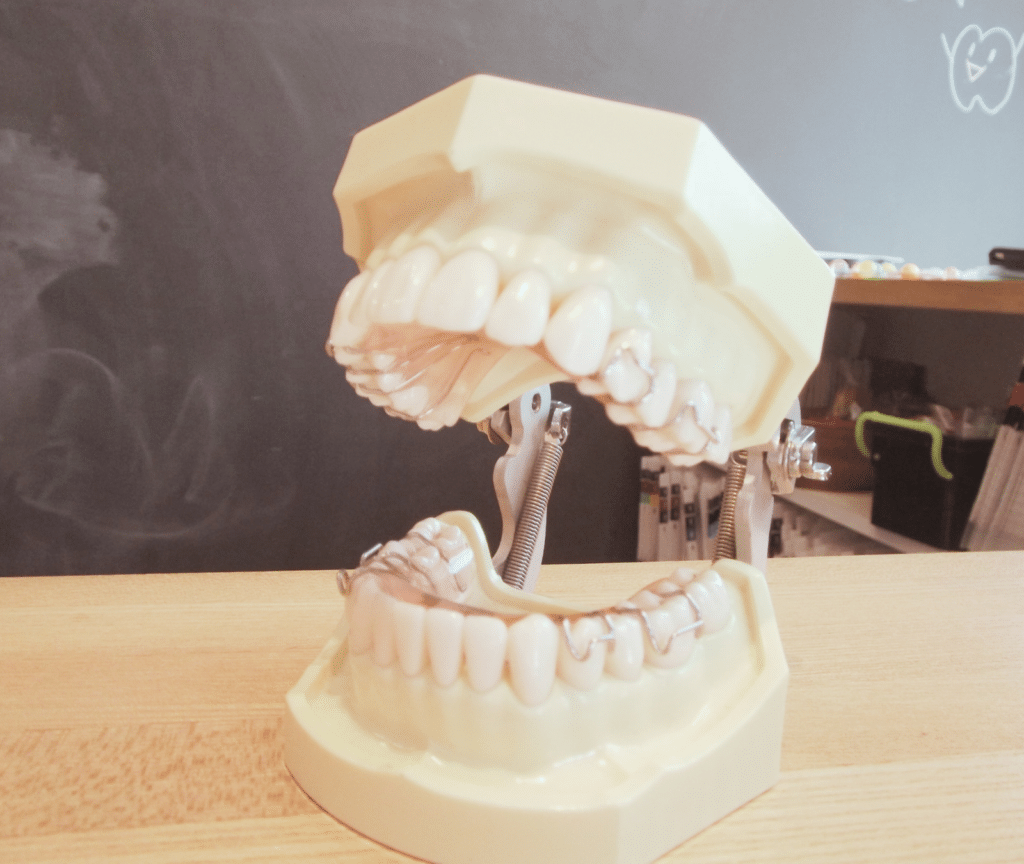 矯正装置と歯の模型