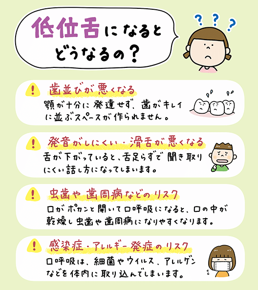 自宅でカンタン舌トレ_3_子供の舌トレーニング法を図解したイラスト。正しい舌の位置、あいうべ体操、音鳴らし、風船遊びなどのトレーニング方法、小児矯正における舌トレの重要性を視覚的に説明。