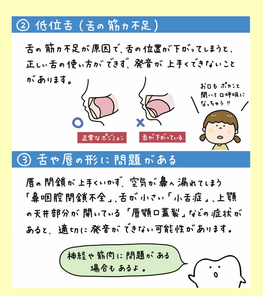 サ行とタ行が言えない_4_子供の滑舌が悪い原因と歯並びの関係について解説するイラスト