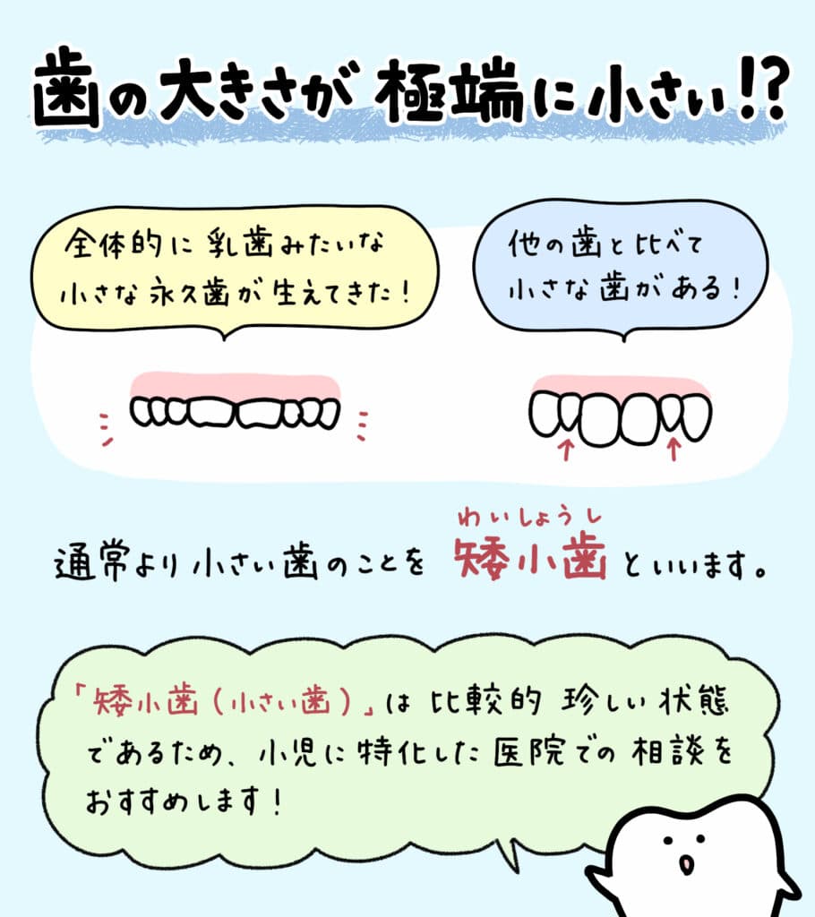 歯が小さいと言われたら_1_子どもの小さい歯である矮小歯についての解説をするイラスト