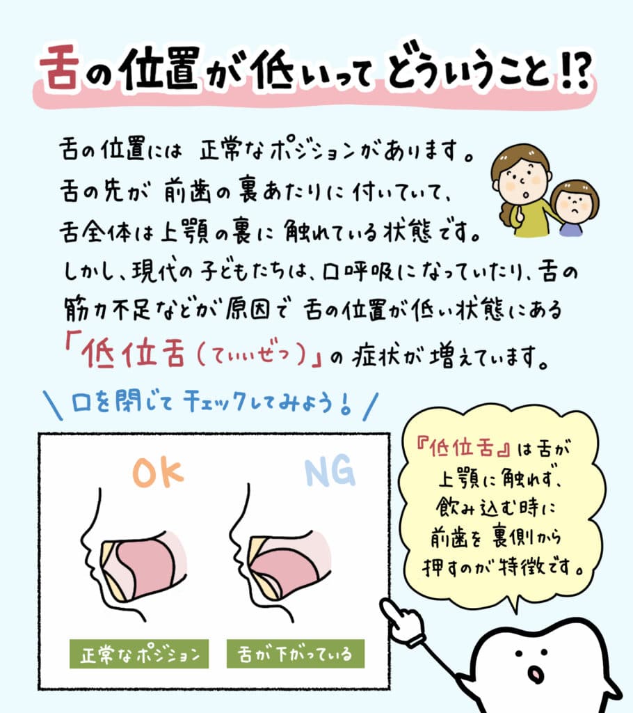 舌の位置が低い子供は_1_舌の低い位置が口腔健康に及ぼす影響について学ぶ子供のイラスト解説