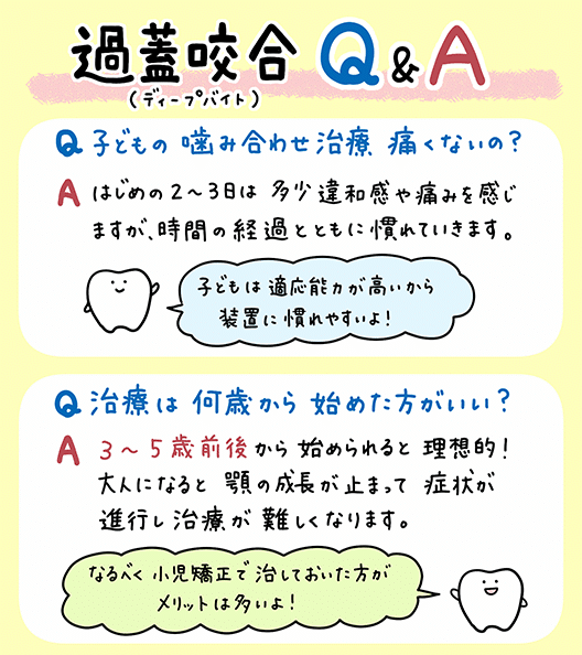 子供の噛み合わせ深い_7_子供の深い噛み合わせである過蓋咬合ディープバイトの原因と治療法を説明するイラスト。噛み合わせの状態や治療法を視覚的に解説。