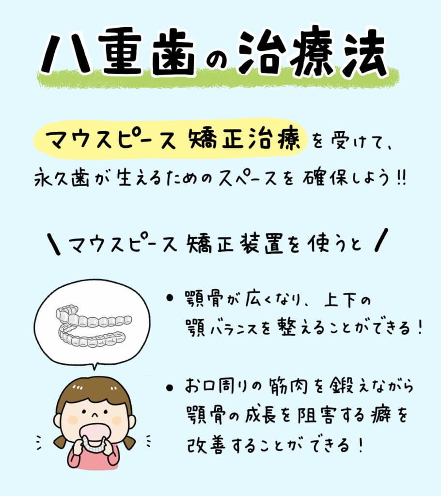 子供の八重歯が変な位置から_7_子供の八重歯の対処法と治療法を解説する記事のイラスト解説画像