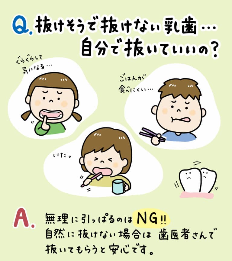 乳歯がぐらぐらしてきた_1_子供の乳歯が抜けない場合の対処法を示す教育的なイラスト