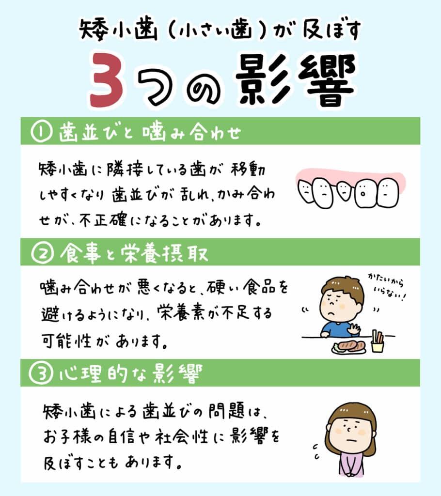 歯が小さいと言われたら_3_子どもの小さい歯である矮小歯についての解説をするイラスト