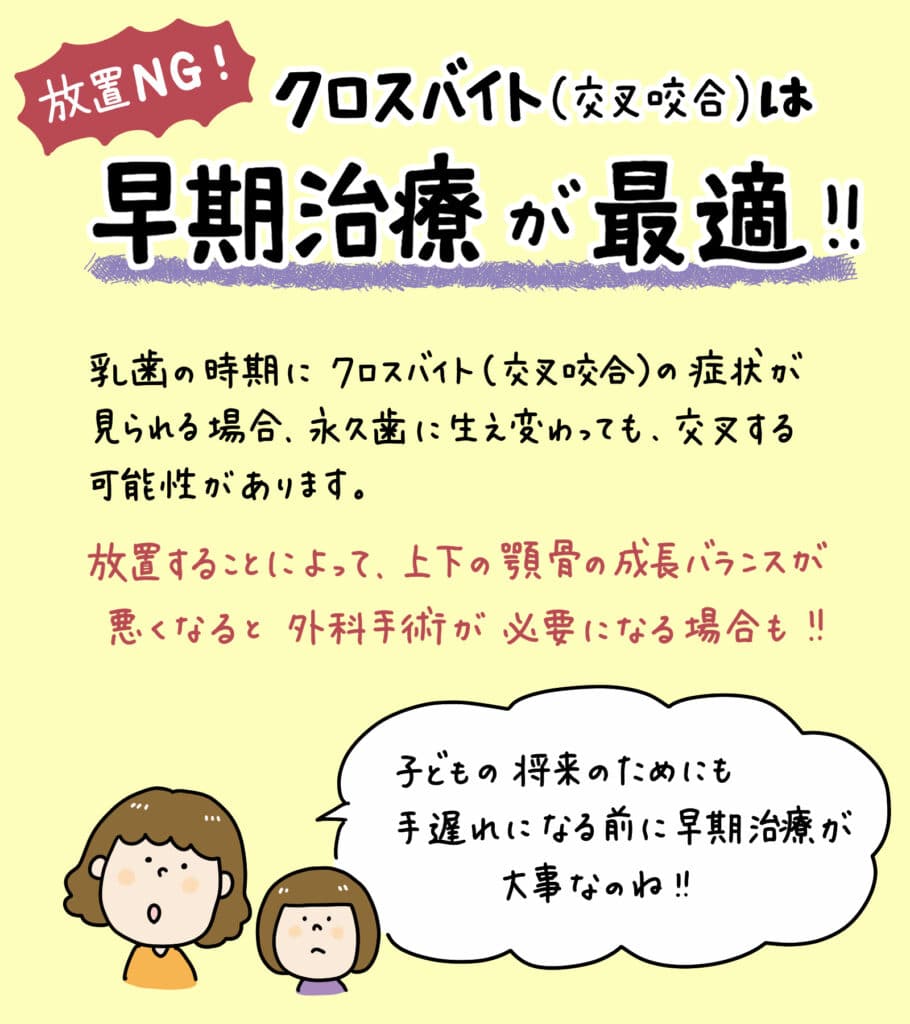 子どもが交叉咬合_4_子供の交叉咬合（クロスバイト）の原因と治療法を解説するイラスト