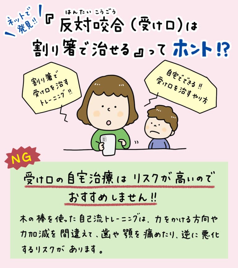 子供の反対咬合（受け口）を割り箸で治すのは危険_1_小児の反対咬合の治療に関する画像