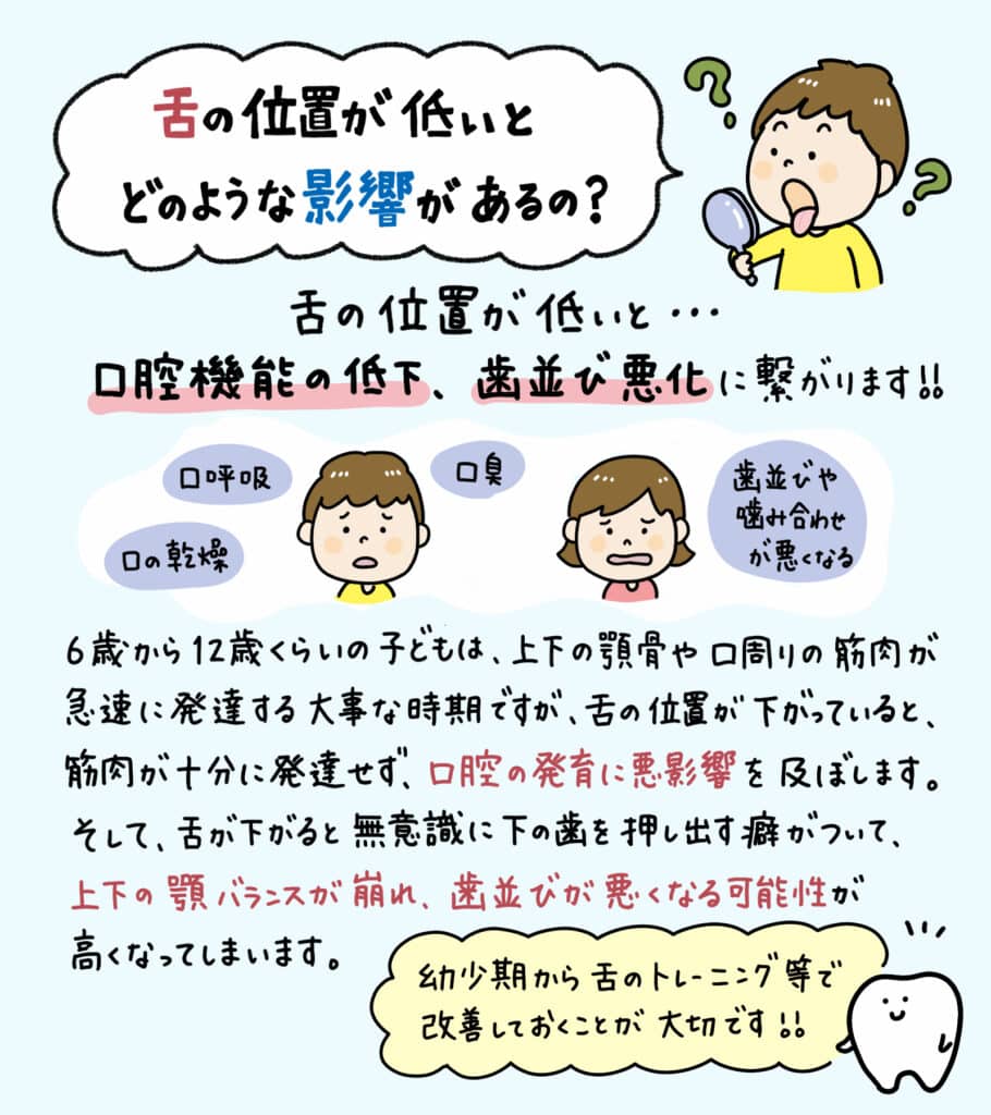 舌の位置が低い子供は_2_舌の低い位置が口腔健康に及ぼす影響について学ぶ子供のイラスト解説