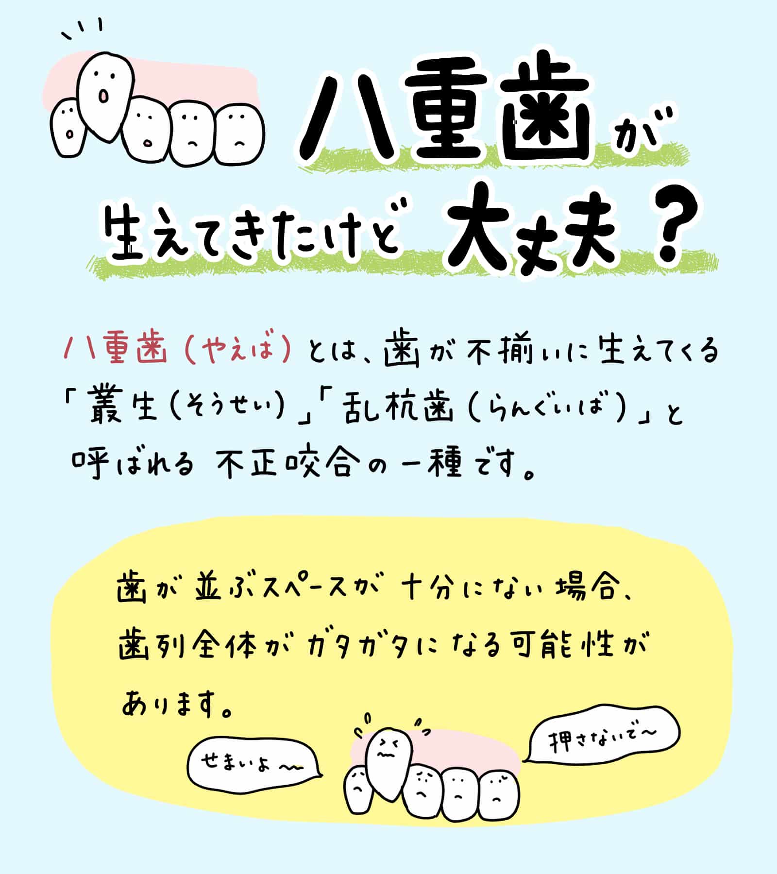 子供の八重歯が変な位置から_1_子供の八重歯の対処法と治療法を解説する記事のイラスト解説画像