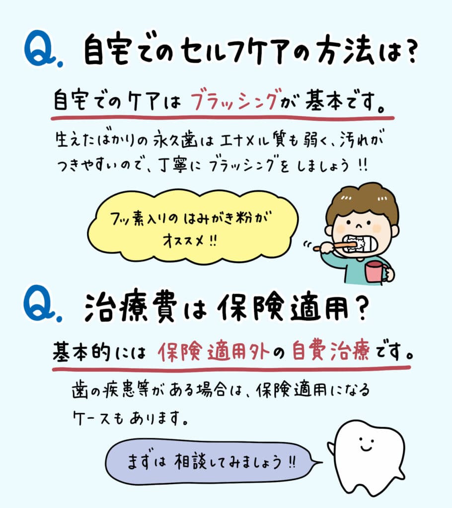 子供の二重歯列（二枚歯）とは？_6_子供の二重歯列（二枚歯）の状態とその治療法についての詳細なイラスト解説