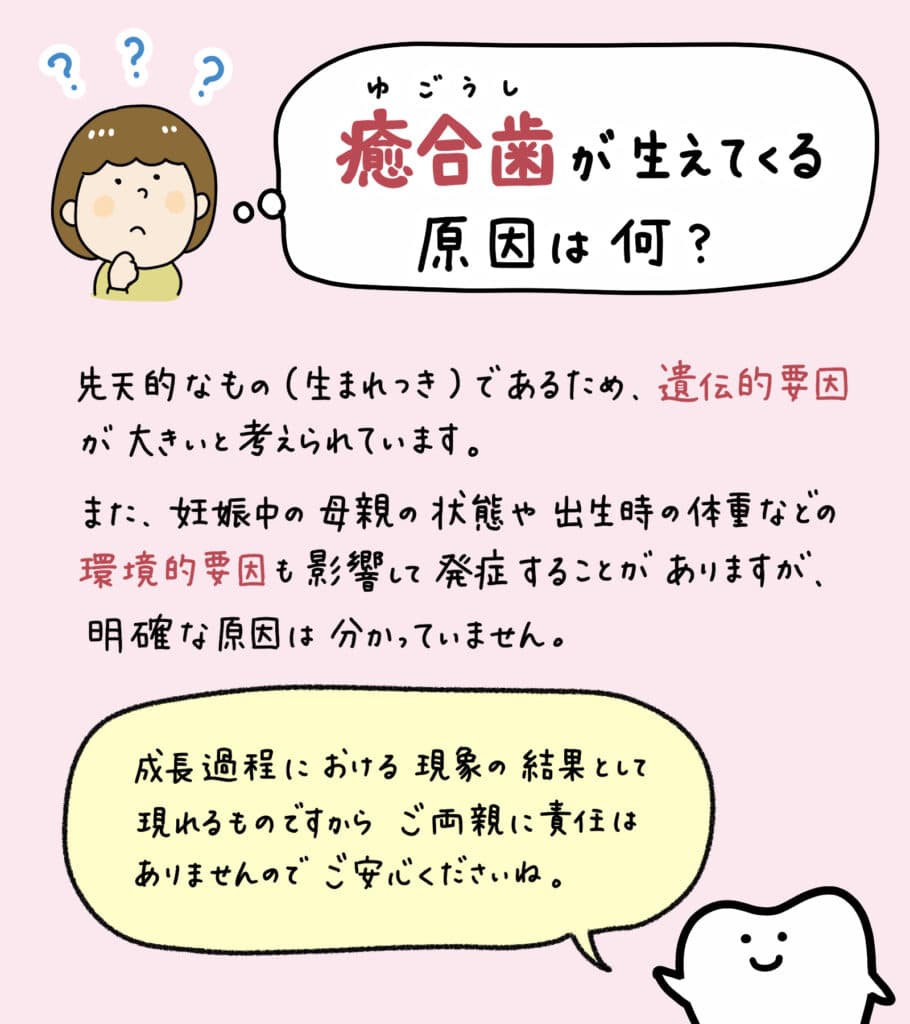 歯科検診で癒合歯と診断されたら？_5_子供の歯の癒合歯について解説するイラスト