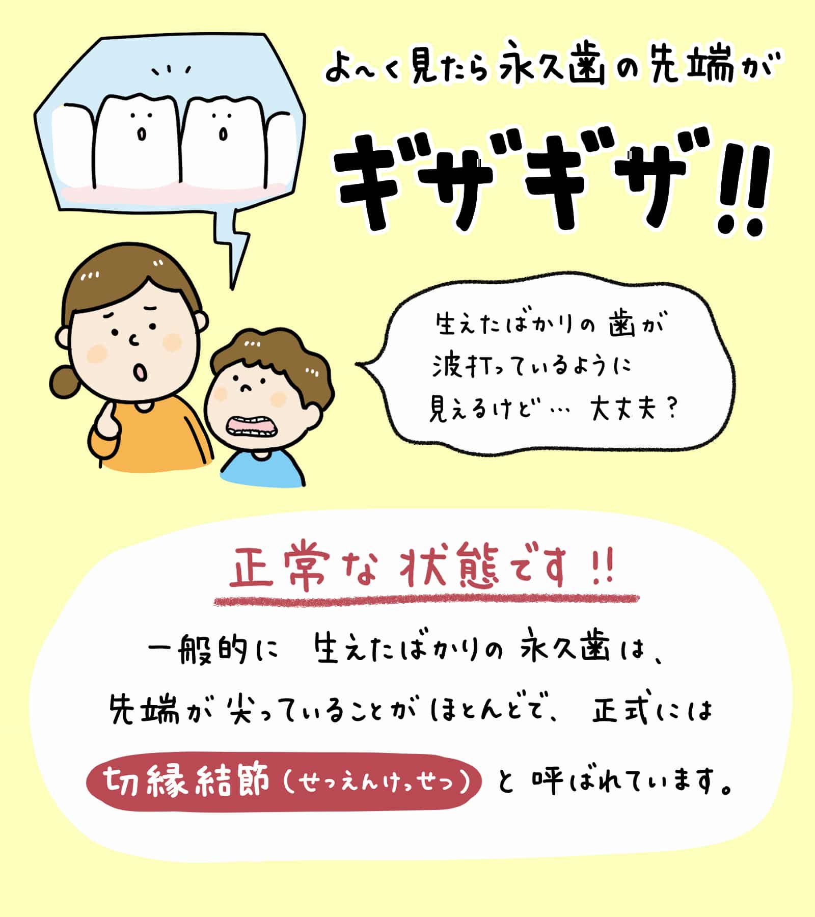 子供の生えた歯ギザギザ_1_子供の新しい永久歯が尖っていたりギザギザしている様子と、その状態が正常であることを説明しているイラスト