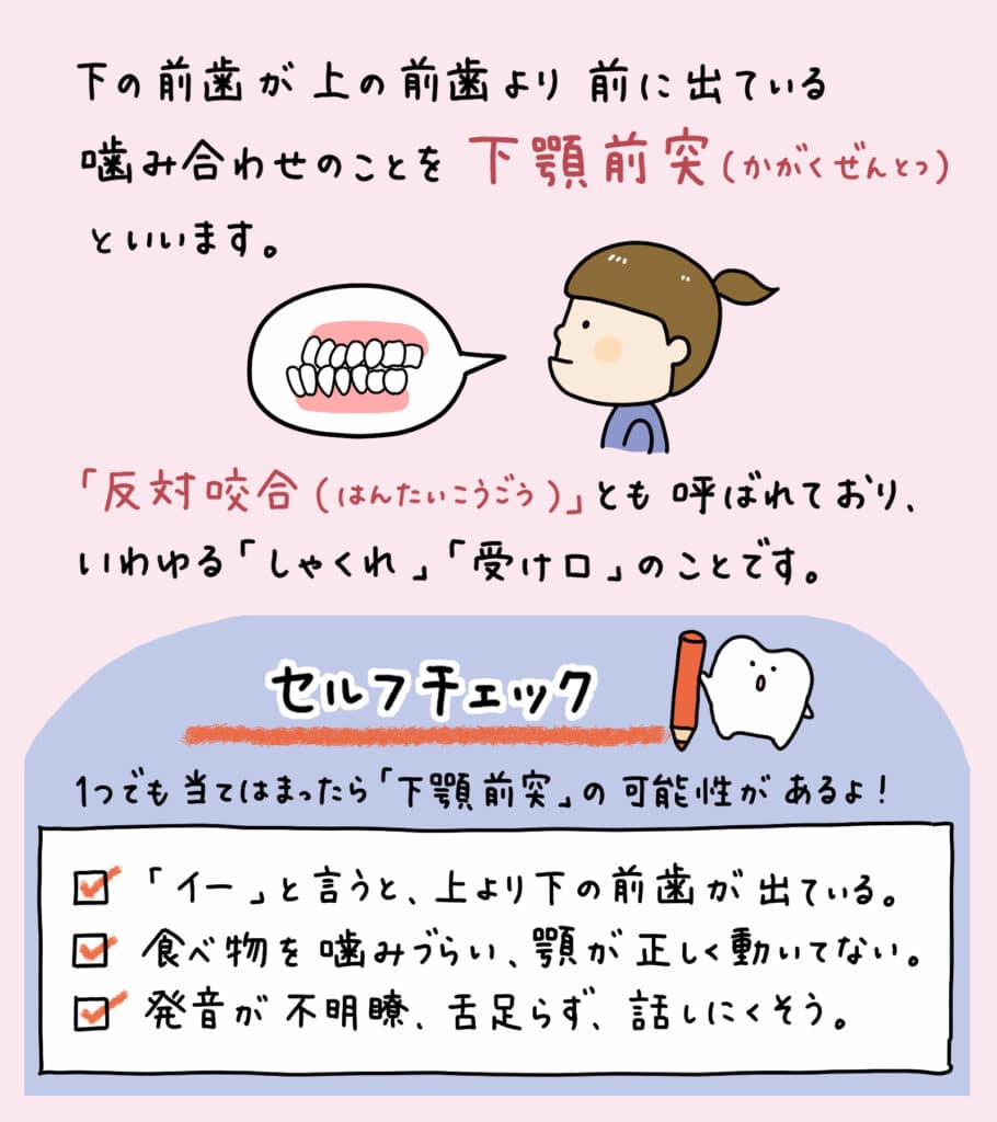 子供が笑うと下顎が出る_2_子供の下顎が前に出る原因と治療法について説明するイラストで治療法や予防策を紹介