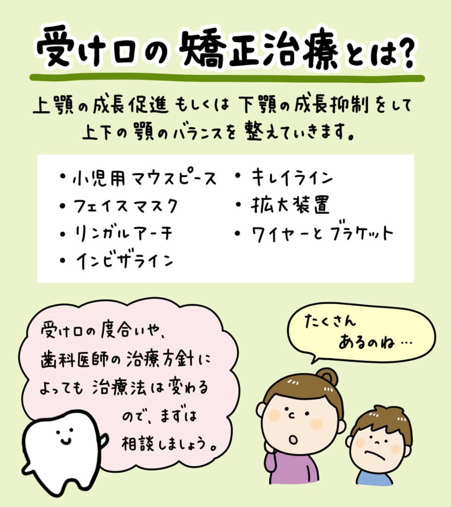 子供の受け口(反対咬合)_4_小児歯科医が子供の反対咬合（受け口）の状態と矯正方法を解説するイラスト