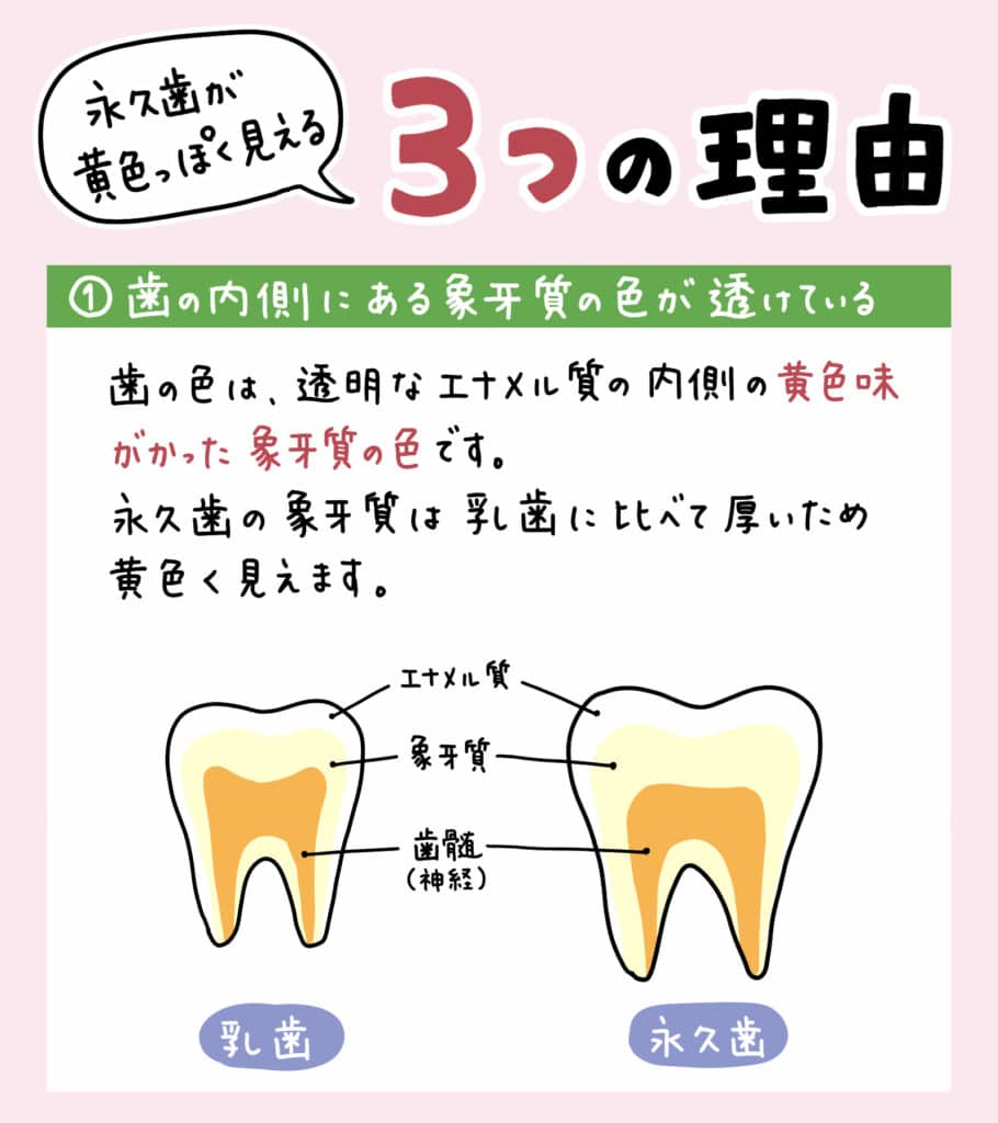 子どもの生えてきた永久歯が_2_子どもの永久歯と乳歯の比較、黄色に見える理由を解説するイラスト、適切な対策を示す図と解説