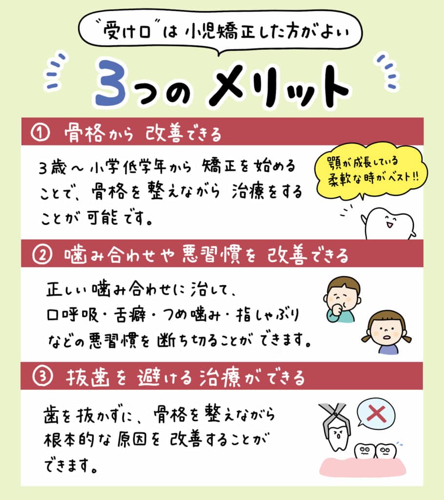 子供の受け口(反対咬合)_5_小児歯科医が子供の反対咬合（受け口）の状態と矯正方法を解説するイラスト