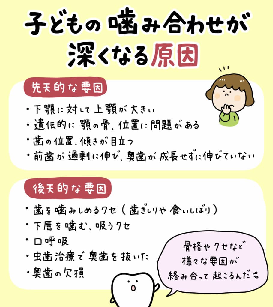 子供の噛み合わせ深い_5_子供の深い噛み合わせである過蓋咬合ディープバイトの原因と治療法を説明するイラスト。噛み合わせの状態や治療法を視覚的に解説。