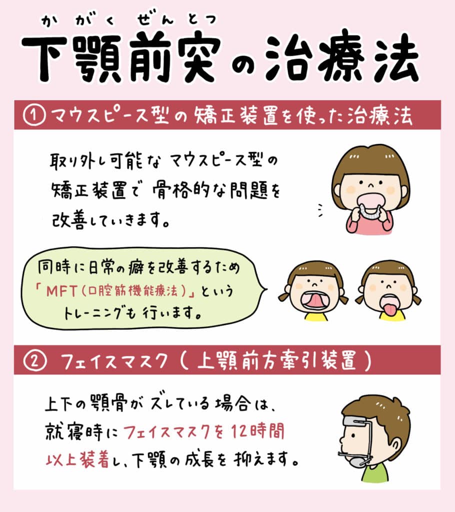 子供が笑うと下顎が出る_7_子供の下顎が前に出る原因と治療法について説明するイラストで治療法や予防策を紹介