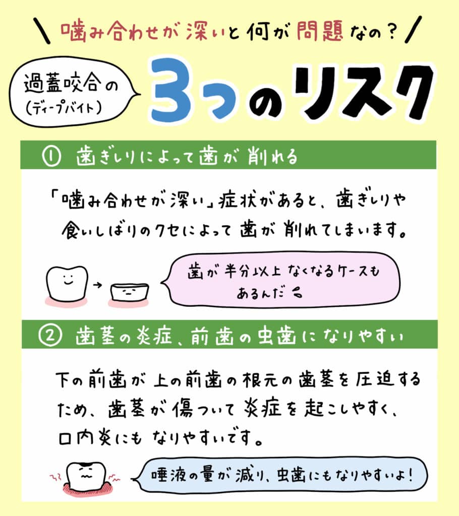 子供の噛み合わせ深い_3_子供の深い噛み合わせである過蓋咬合ディープバイトの原因と治療法を説明するイラスト。噛み合わせの状態や治療法を視覚的に解説。