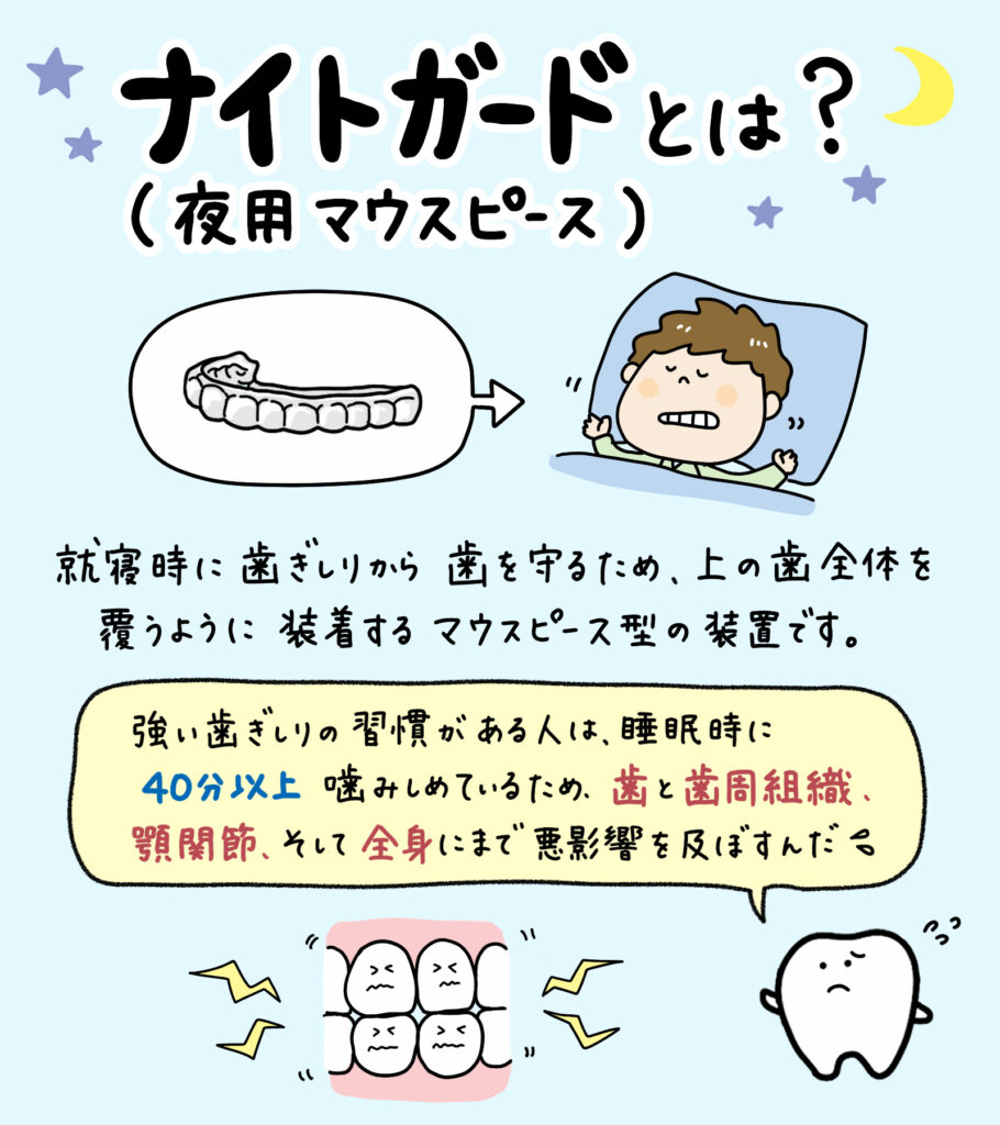 子どものナイトガード_1_子どもの夜用マウスピースの穴あき原因と対策を図解：歯ぎしりによる損傷メカニズム、正しい装着方法、定期的なチェックポイントをイラストで解説。