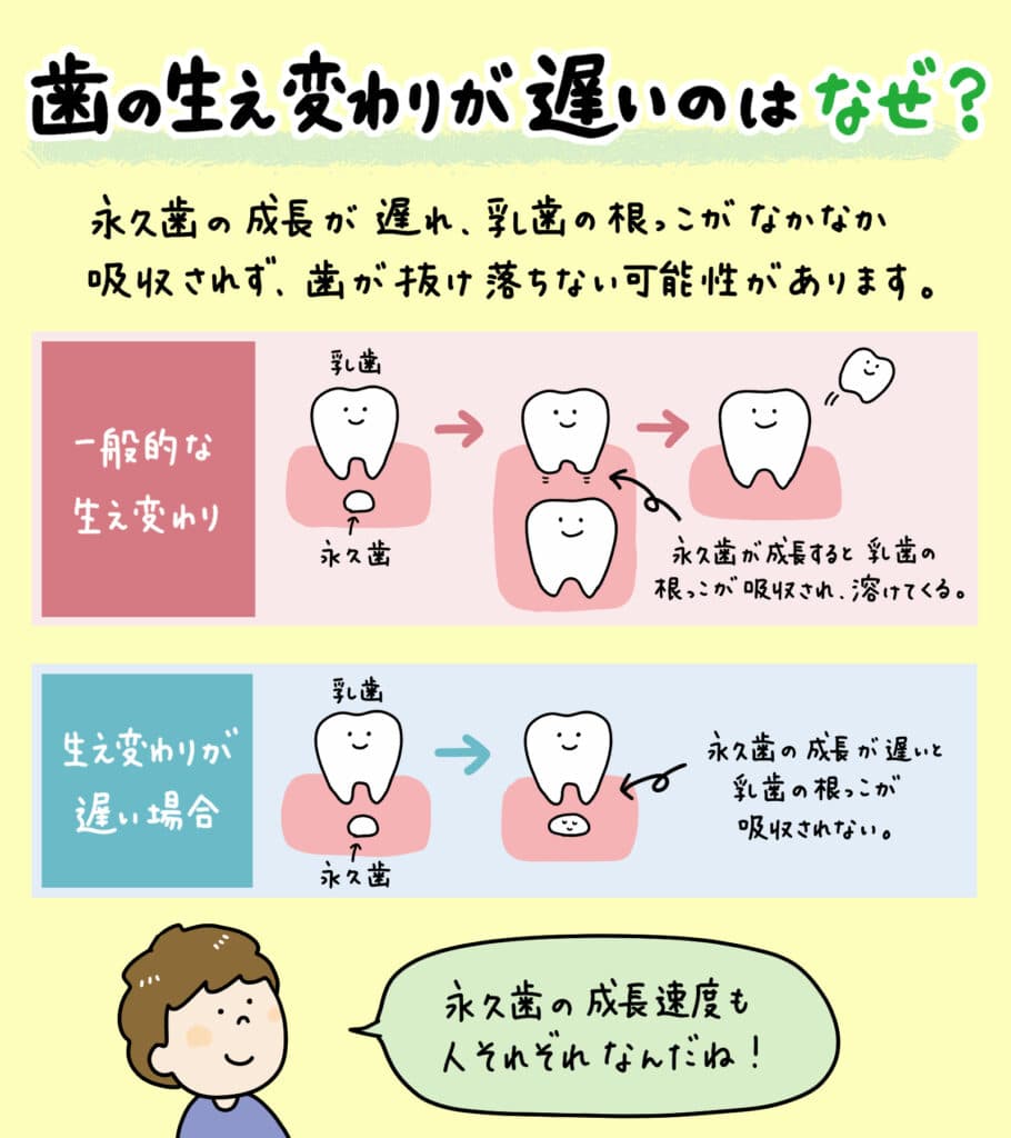 子供の乳歯_歯の生え変わりが遅い_3_歯の生え変わりが遅い理由とメリット、注意点を説明する図解イラスト。小児歯科医によるアドバイス付き。