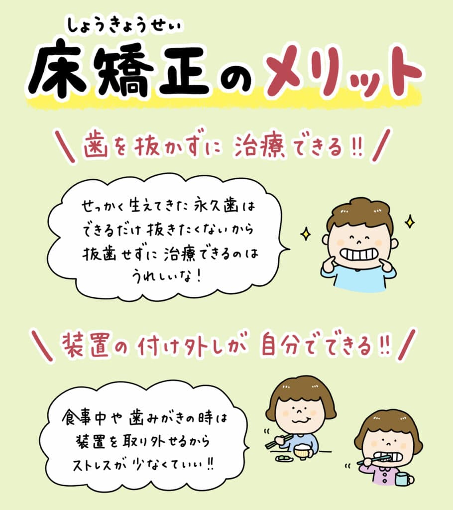 床矯正 拡大床を使うと_6_拡大床による床矯正の仕組みと顔への影響を説明するイラスト。顎の拡大と歯列矯正の過程を示し、顔の輪郭が変わらないことを視覚的に解説。