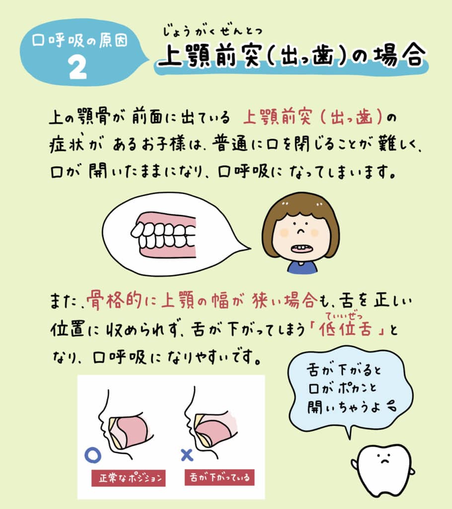 赤ちゃんの鼻呼吸が口呼吸に変わる仕組み_3_解説イラスト