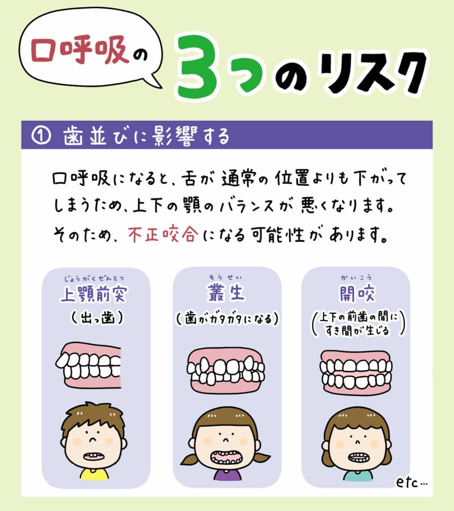 赤ちゃんの鼻呼吸が口呼吸に変わる仕組み_7_解説イラスト