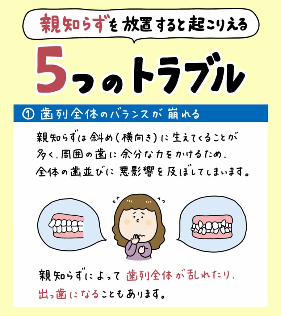 親知らずと歯並びの関係_7_親知らずが子どもの歯並びに影響するかどうか？についての解説イラスト