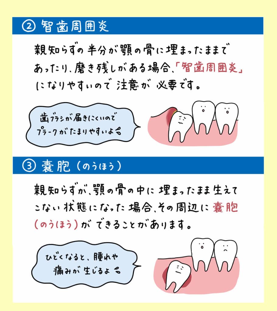 親知らずと歯並びの関係_8_親知らずが子どもの歯並びに影響するかどうか？についての解説イラスト