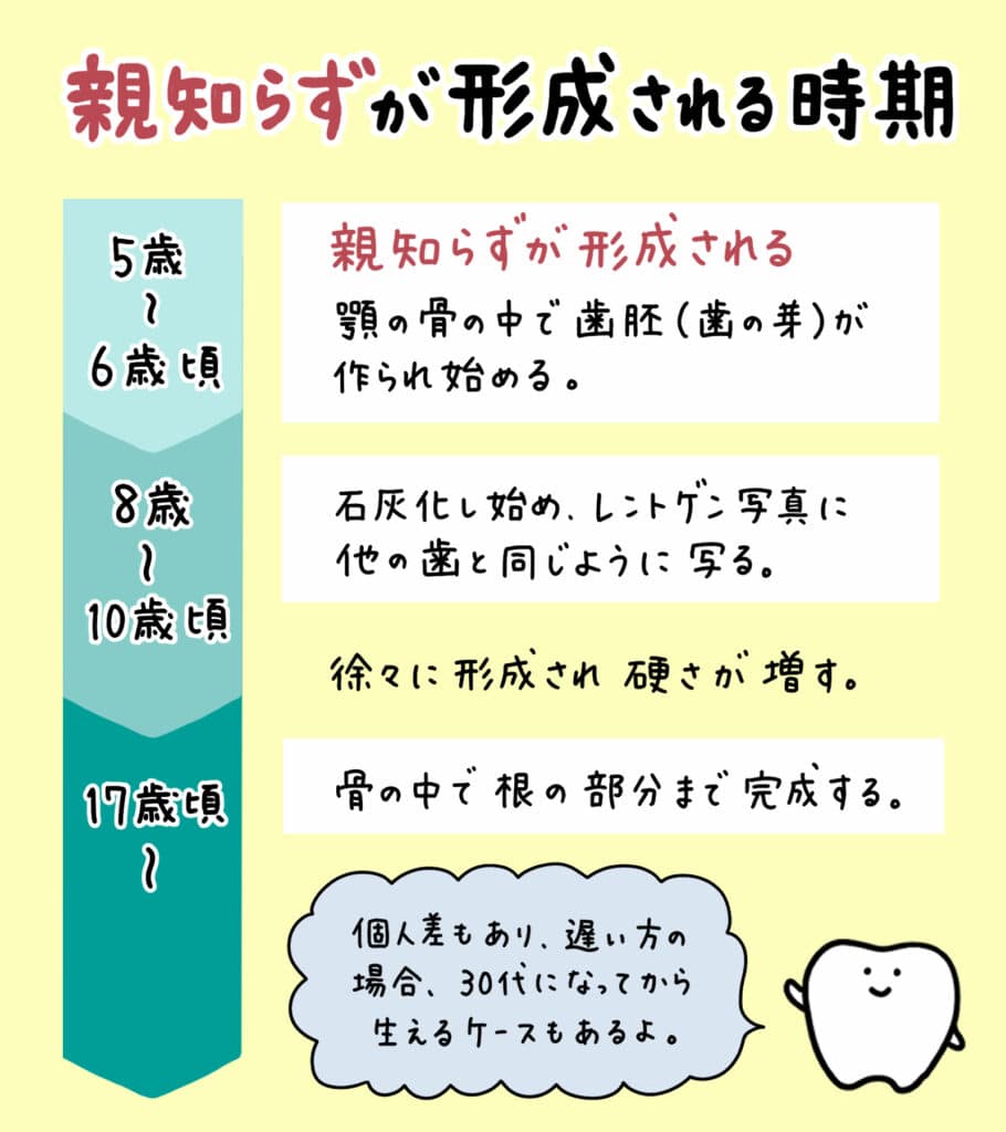 親知らずと歯並びの関係_4_親知らずが子どもの歯並びに影響するかどうか？についての解説イラスト